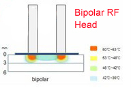 Elight + máquina bipolar del retiro del pelo del RF con blanquea la piel del cuerpo