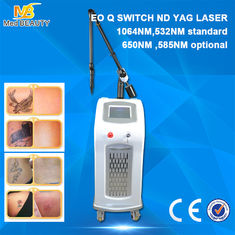 China Professional q switched nd yag laser tattoo removal machine with best result proveedor