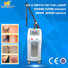 China Professional q switched nd yag laser tattoo removal machine with best result fábrica